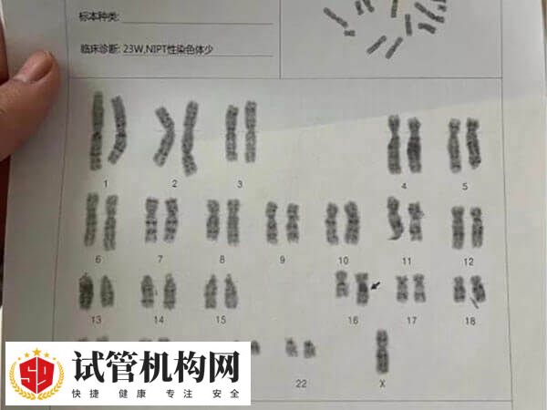 二代试管不可以筛查染色体
