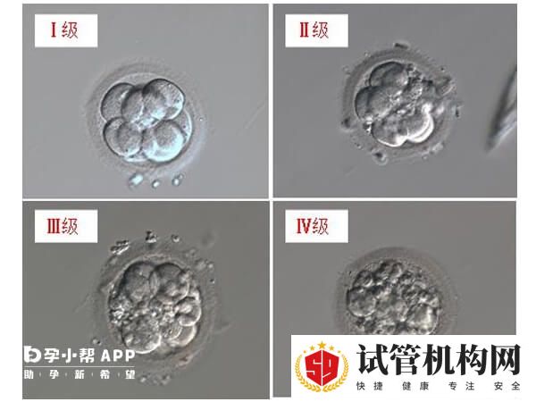 胚胎进行等级划分