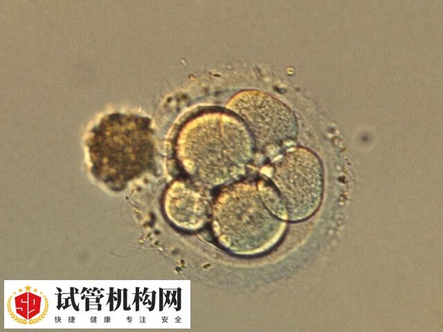 囊胚移植成功率高