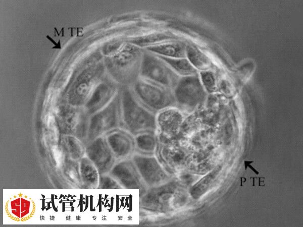 囊胚培养要求的条件高