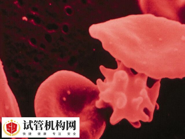 b型地中海贫血能不能生孩子